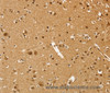 Immunohistochemistry of paraffin-embedded Human brain  using PSMC1 Polyclonal Antibody at dilution of 1:40