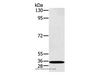 Western Blot analysis of K562 cell using RAB27A Polyclonal Antibody at dilution of 1:400
