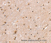 Immunohistochemistry of paraffin-embedded Human brain  using SMARCB1 Polyclonal Antibody at dilution of 1:30