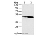 Western Blot analysis of Hepg2 and hela cell using SNX8 Polyclonal Antibody at dilution of 1:400