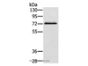 Western Blot analysis of Hepg2 cell using SSX2IP Polyclonal Antibody at dilution of 1:500