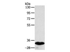 Western Blot analysis of Human fetal intestines tissue using SULT1B1 Polyclonal Antibody at dilution of 1:800