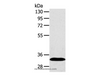 Western Blot analysis of Human fetal liver tissue using SULT2A1 Polyclonal Antibody at dilution of 1:650