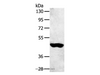 Western Blot analysis of 231 cell using SULT2B1 Polyclonal Antibody at dilution of 1:800