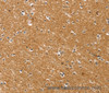 Immunohistochemistry of paraffin-embedded Human brain tissue using SYTL5 Polyclonal Antibody at dilution 1:50