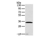 Western Blot analysis of Mouse lung tissue using STX11 Polyclonal Antibody at dilution of 1:400