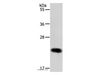 Western Blot analysis of MCF-7 cell using RAB22A Polyclonal Antibody at dilution of 1:650