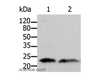 Western Blot analysis of Human fetal brain and kidney tissue using ARF1 Polyclonal Antibody at dilution of 1:500