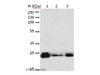 Western Blot analysis of 293T cell and Mouse brain tissue, A549, Hela, A172 and HT-29 cell using RAB6A Polyclonal Antibody at dilution of 1:650