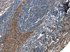 Immunohistochemistry of paraffin-embedded Human tonsil  tissue using AQP2 Polyclonal Antibody at dilution 1:100