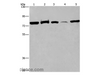 Western Blot analysis of 293T cell, Human fetal brain tissue and K562 cell, Human fetal liver tissue and Hela cell using ACVR2A Polyclonal Antibody at dilution of 1:400