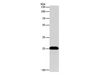 Western Blot analysis of Hela cell using BCL2 Polyclonal Antibody at dilution of 1:650