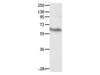 Western Blot analysis of Huamn fetal brain tissue using CRMP3 Polyclonal Antibody at dilution of 1:500