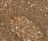 Immunohistochemistry of paraffin-embedded Human tonsil tissue using SLC6A3 Polyclonal Antibody at dilution 1:50