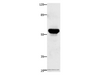 Western Blot analysis of Human fetal brain tissue using TNFRSF21 Polyclonal Antibody at dilution of 1:420