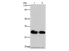 Western Blot analysis of 293T and Hela cell using GJB6 Polyclonal Antibody at dilution of 1:600