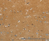 Immunohistochemistry of paraffin-embedded Human brain using GJB6 Polyclonal Antibody at dilution of 1:30