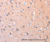 Immunohistochemistry of paraffin-embedded Human brain using FAK Polyclonal Antibody at dilution of 1:75