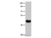 Western Blot analysis of Human fetal muscle tissue   using UTS2R Polyclonal Antibody at dilution of 1:400