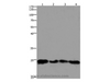 Western Blot analysis of 293T and hela cell, Mouse lung and brain tissue using HMGB3 Polyclonal Antibody at dilution of 1:400