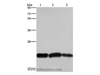 Western Blot analysis of A375 and Raji cell, Human fetal brain tissue using CBX3 Polyclonal Antibody at dilution of 1:600
