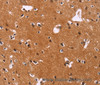 Immunohistochemistry of paraffin-embedded Human brain  using CBX3 Polyclonal Antibody at dilution of 1:40