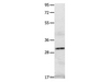 Western Blot analysis of A549 cell   using IL2RA Polyclonal Antibody at dilution of 1:750