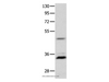 Western Blot analysis of Mouse intestinum tenue tissue   using MC1R Polyclonal Antibody at dilution of 1:1450