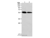 Western Blot analysis of Human colon and ovarian cancer tissue using MMP11 Polyclonal Antibody at dilution of 1:600