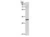 Western Blot analysis of 293T cell using MMP26 Polyclonal Antibody at dilution of 1:500