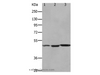 Western Blot analysis of Mouse kidney , brain and heart tissue using HCRTR2 Polyclonal Antibody at dilution of 1:1100