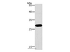Western Blot analysis of Jurkat cell using PAX5 Polyclonal Antibody at dilution of 1:550