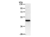 Western Blot analysis of Mouse heart tissue using PDK2 Polyclonal Antibody at dilution of 1:500
