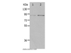 Western Blot analysis of Hela and 293T cell using PIBF1 Polyclonal Antibody at dilution of 1:400