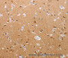 Immunohistochemistry of paraffin-embedded Human brain using PFN2 Polyclonal Antibody at dilution of 1:30