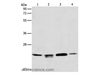 Western Blot analysis of 293T, hela and PC3 cell, Human liver cancer tissue using PRDX2 Polyclonal Antibody at dilution of 1:750