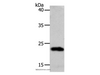 Western Blot analysis of 231 cell using SOCS1 Polyclonal Antibody at dilution of 1:1300