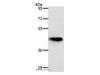 Western Blot analysis of Mouse lung tissue using NKX2-1 Polyclonal Antibody at dilution of 1:700