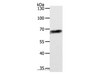Western Blot analysis of Jurkat cell using ABCD4 Polyclonal Antibody at dilution of 1:700