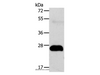Western Blot analysis of Human fetal liver cancer tissue using AGPAT2 Polyclonal Antibody at dilution of 1:400
