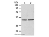 Western Blot analysis of Human fetal liver tissue and hepg2 cell using AGXT Polyclonal Antibody at dilution of 1:1050