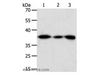 Western Blot analysis of Human liver cancer tissue, hela cell and Human fetal kidney tissue using AKR1A1 Polyclonal Antibody at dilution of 1:450