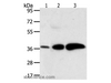 Western Blot analysis of Human liver cancer and breast infiltRative duct tissue, Human fetal brain tissue using AKR1C1 Polyclonal Antibody at dilution of 1:500