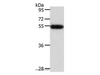 Western Blot analysis of Human liver cancer tissue using AGT Polyclonal Antibody at dilution of 1:600