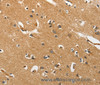 Immunohistochemistry of paraffin-embedded Human brain tissue using EPHB3 Polyclonal Antibody at dilution 1:40