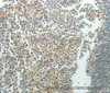 Immunohistochemistry of paraffin-embedded Human tonsil using NDRG3 Polyclonal Antibody at dilution of 1:70