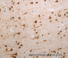 Immunohistochemistry of paraffin-embedded Human brain tissue using MDC1 Polyclonal Antibody at dilution 1:80