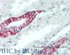 Immunohistochemistry of paraffin-embedded Kidney tissue using SCN10A Polyclonal Antibody at dilution of 1:100(Elabscience® Product Detected by Lifespan).