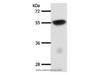 Western Blot analysis of Mouse brain tissue using SLC32A1 Polyclonal Antibody at dilution of 1:950