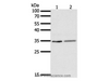 Western Blot analysis of Human fetal lung tissue and A549 cell using SFTPA1 Polyclonal Antibody at dilution of 1:300